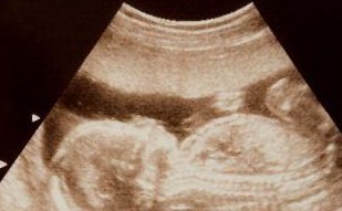 泰国试管婴儿技术为什么好？泰国技术为何更胜一筹？